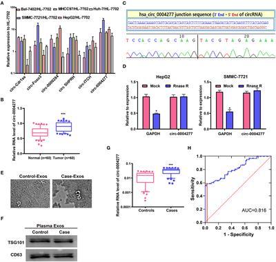 Circular RNA hsa_circ_0004277 Stimulates Malignant Phenotype of Hepatocellular Carcinoma and Epithelial-Mesenchymal Transition of Peripheral Cells